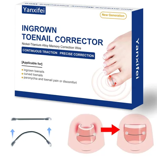 Miniatura 7 de Corrector de uñas encarnadas de nitinol dual, tratamiento de uñas encarnadas, enderezador de uñas curvas, kit de eliminación de uñas encarnadas
