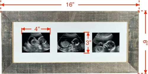 Miniatura 4 de BARNWOODUSA Marco de fotos Sonogram Marco de fotos de recuerdo de progresión de ultrasonido de bebé Marco de fotos de hitos del embarazo 1