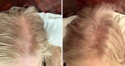 Miniatura 4 de Solución para cabello ralo - Fibras totalmente naturales a base de plantas para una apariencia más completa y gruesa. Cubre instantáneamente