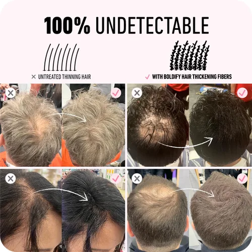 Miniatura 5 de Boldify Fibra capilar + champú + acondicionador: paquete de espesar y crecer para hombres y mujeres (negro)