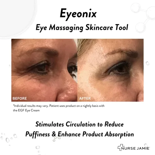 Miniatura 7 de Nurse Jamie Eyeonix - Herramienta de belleza para masaje ocular