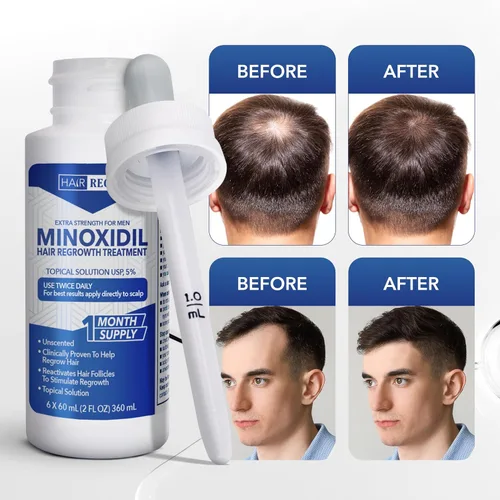 Miniatura 7 de Hair Regen Minoxidil líquido para hombres 5% – Solución tópica avanzada para el crecimiento – Tratamiento de crecimiento para hombres pérdida