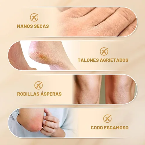 Miniatura 6 de 60% Crema de Urea con 2% Ácido Salicílico, Crema de Urea 60 Por Ciento para Pies y Manos - Hidratante de Fuerza Máxima para Piel Áspera, Seca