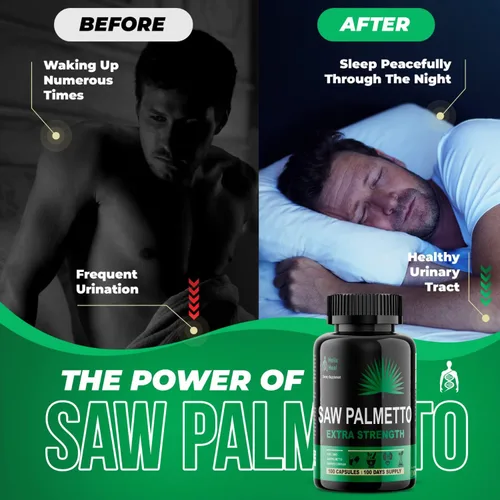 Miniatura 4 de Saw Palmetto para hombres – Suplementos para la salud de la próstata para hombres Salud urinaria – Bloqueador natural de DHT, 500 mg tratamientos