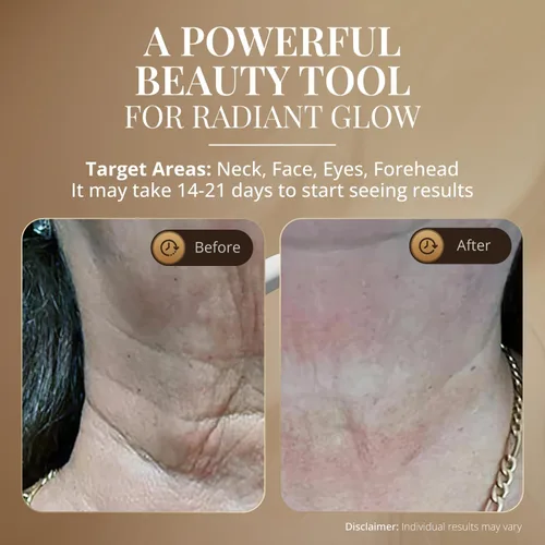 Miniatura 4 de GLO24K - Dispositivo de belleza facial y cuello con luz roja, herramienta de masajeador facial 3 en 1 con LED y vibración para revitalización