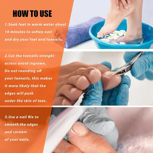 Miniatura 5 de Cortauñas de podólogo resistentes para uñas gruesas y encarnadas, cortauñas de acero inoxidable forjado a mano para hombres, mujeres y personas