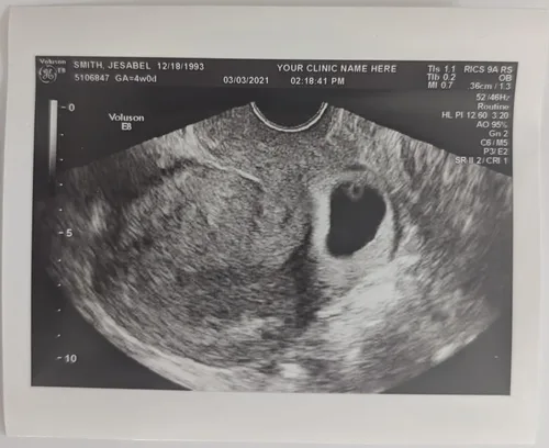 Broma de ultrasonido falso personalizado 2D, foto única SOLO, SIN género