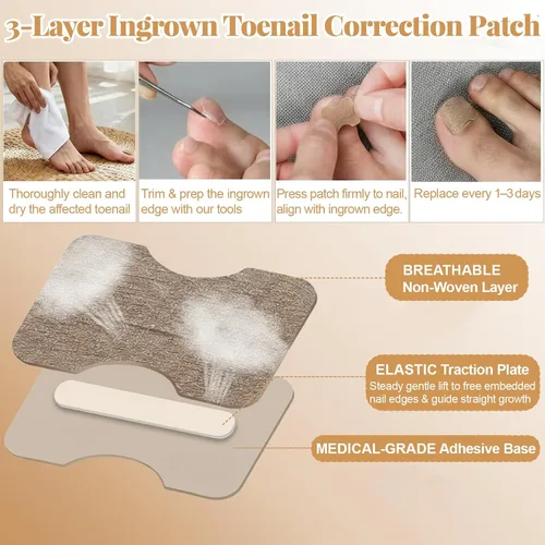 Miniatura 4 de Kit de eliminación y corrector de uñas encarnadas para un alivio rápido del dolor, kit profesional de tratamiento de uñas encarnadas con tiras