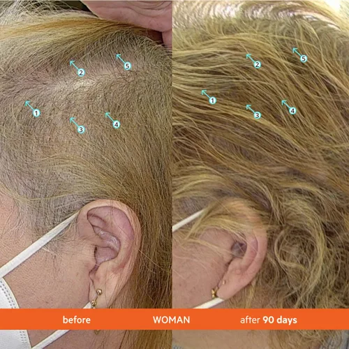 Miniatura 4 de Revita Tablets Vitaminas para el crecimiento del cabello de DS Laboratories, promueve el crecimiento del cabello en mujeres y hombres, experimenta