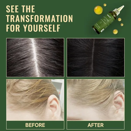 Miniatura 2 de Aceite de Batana - Aceite orgánico Dr. Sebi para el crecimiento del cabello, 100% puro y natural de Honduras, cuero cabelludo profundamente