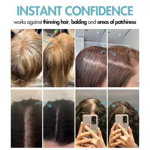 Miniatura 4 de Hair Genetics Cubre las raíces de tus canas, oculta las raíces de tus canas, nueva tecnología de polvo mineral de aspecto natural Resultados