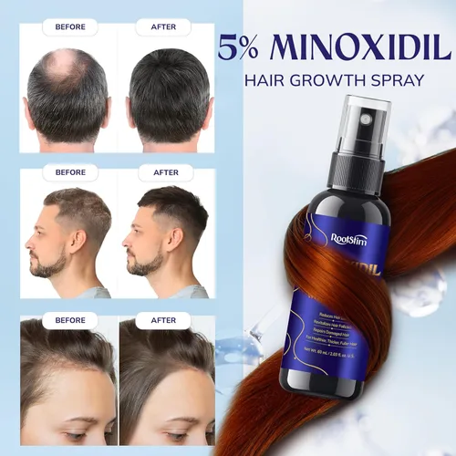 Miniatura 3 de 5% Minoxidil Hair Growth for Men and Women: Extra Strength Minoxidil Hair Loss Treatment Serum with Rosemary for Faster Stronger Thicker Hair Growth