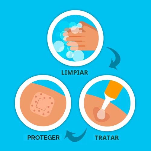 Miniatura 6 de BAND-AID Brand Sheer Spots - Vendajes adhesivos cuadrados pequeños transparentes, estériles, envueltos individualmente, discretos para primeros