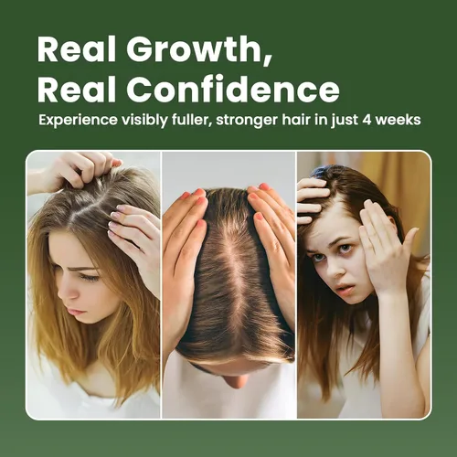 Miniatura 5 de Aceite para el crecimiento del cabello con aceite de ricino de romero, fórmula fortalecedora vegana para adelgazar el crecimiento del cabello