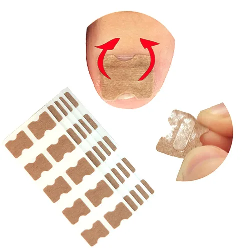 Miniatura 7 de Tratamiento de uñas encarnadas, 50 parches correctores de uñas encarnadas, calcomanías de corrección de uñas de los pies, herramienta profesional