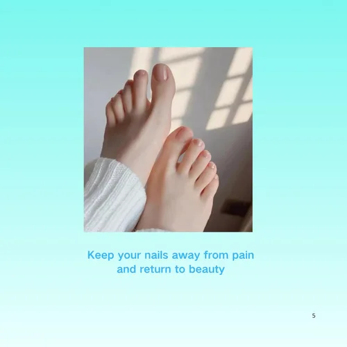 Miniatura 5 de Juego de corrector de uñas encarnadas con parche de corrección de uñas curvas, kit de eliminación de uñas mejorado, herramientas de pedicura