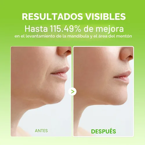 Miniatura 5 de Dr.Melaxin CACTOX V-Lifting Mewing Band – Cactox + Cafeína + Colágeno Banda de elevación de doble barbilla para flacidez de la mandíbula e hinchazón