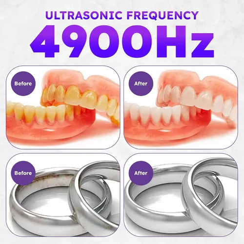 Miniatura 7 de Limpiador ultrasónico de retenedores – Limpiador de dentaduras postizas de 49 kHz para protectores bucales, retenedores, alineadores, joyas