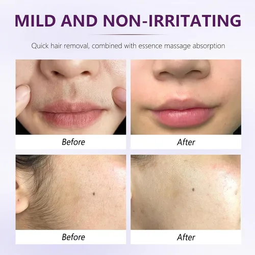 Miniatura 5 de Crema depilatoria facial para mujeres, kit de cremas depilatorias faciales suaves con raspado, suero calmante, crema removedor de vello corporal