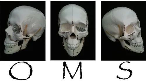 Miniatura 3 de CafePress OMS - Taza quirúrgica con diseño de calavera de 11 oz (11.0 fl oz)