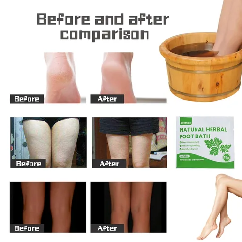 Miniatura 5 de Remojo natural para pies de artemisa/ajenjo, bolsa de baño de pies de jengibre linfático, spa de pies antihinchazón que promueve el metabolismo