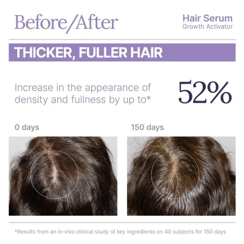 Miniatura 6 de Keranique Suero activador del crecimiento del cabello para mujeres, revitalizador multipéptido del cuero cabelludo para adelgazamiento del cabello