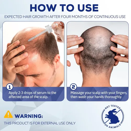 Miniatura 6 de 5% de mininoxidil para hombres y mujeres, suero de biotina para el crecimiento del cabello, tratamientos de recrecimiento de barba y cabello