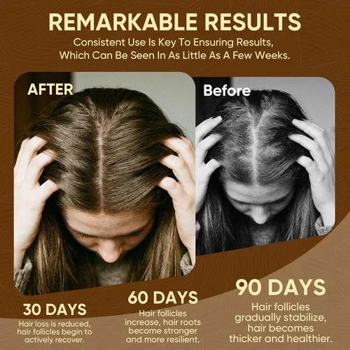 Miniatura 2 de Aceite de batana para el crecimiento del cabello, 100% puro y natural, reduce la pérdida de cabello y desintoxica tu cuero cabelludo, nutre el cuero