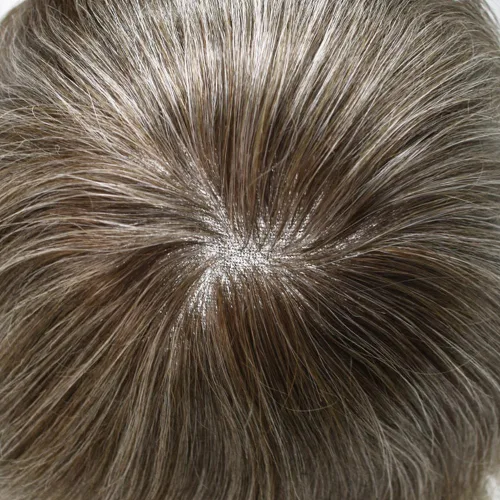 Miniatura 24 de Sistema de repuesto de cabello humano europeo con encaje frontal suizo para hombre, tupé para hombre, pieza de cabello, nudo blanqueado, línea #17