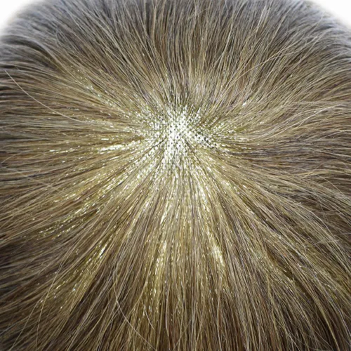 Miniatura 7 de LYRICAL HAIR Toupee - Peluca de cabello humano de aspecto natural para hombre, con encaje fino y mono, sistema de cabello de repuesto para hombre