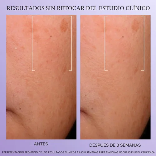 Miniatura 5 de Lancôme Rénergie H.C.F. Triple Serum - Suero de ácido hialurónico para corrección visible de signos antienvejecimiento y manchas oscuras - Con