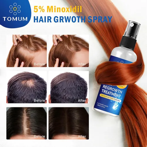 Miniatura 7 de Minoxidil para hombres y mujeres Crecimiento del cabello: 5% de minoxidil en aerosol tópico Tratamiento para el crecimiento del cabello Detener