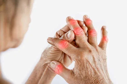 Miniatura 2 de GC® GoutCare (paquete de 3): Control de ácido úrico Prevención del ácido úrico Suplemento de salud articular Alivio de las articulaciones