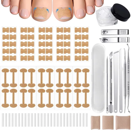 Kit corrector de uñas encarnadas de 201 piezas con tiras de corrección transpirables, parches de uñas curvas, herramientas levantadoras de uñas de