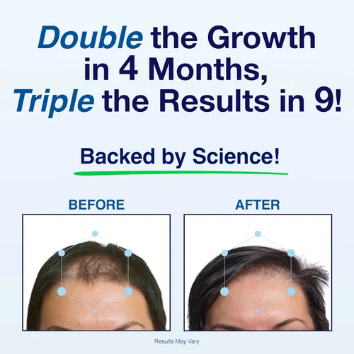 Miniatura 3 de Vitaminas para el crecimiento del cabello para mujeres y hombres, vitaminas patentadas para el crecimiento del cabello para mujeres y hombres