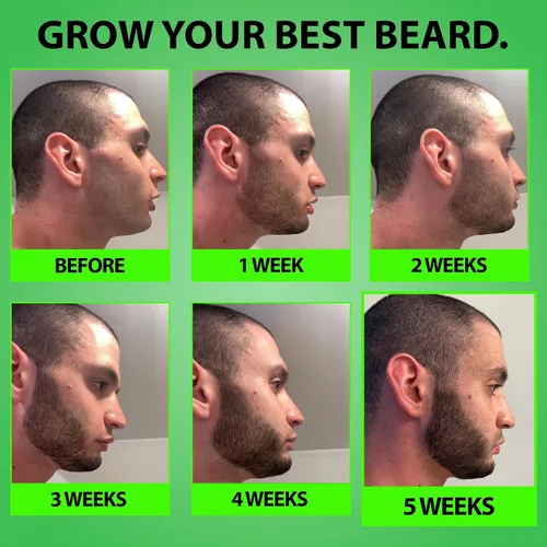 Miniatura 4 de Minoxidil para el crecimiento de la barba: suero al 5% con 2 veces biotina y agua de arroz, promueve el cabello facial más grueso y lleno, ideal