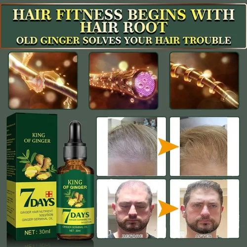 Miniatura 3 de Biotin - Suero para el crecimiento del cabello para el tratamiento de la pérdida y el crecimiento del cabello, aceite esencial de jengibre natural