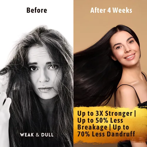 Miniatura 7 de Suero para el crecimiento del cabello para mujeres y hombres — USDA Organic, 10 en 1 Tricho10™ suero para el cuero cabelludo para un cabello más