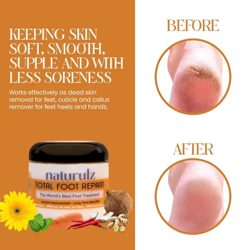 Miniatura 3 de Naturulz Total Foot Repair 4oz – Crema de pies de humedad intensiva para pieles extremadamente secas y ásperas y talones y pies agrietados