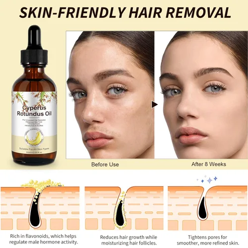 Miniatura 4 de Aceite Cyperus Rotundus, aceite natural de Cyperus Rotundus para depilación, reduce el crecimiento del vello corporal, hidratante y calmante