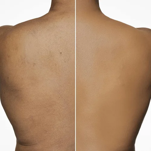 Miniatura 7 de Dermablend Leg and Body Makeup Foundation with SPF 25 90N Medium Natural