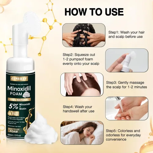 Miniatura 6 de 5% de espuma de minoxidil para hombres y mujeres, ralentiza la pérdida de cabello y promueve el tratamiento de crecimiento del cabello para mujeres