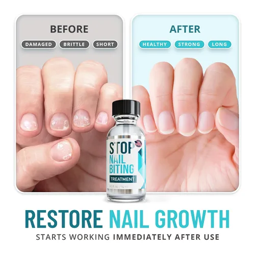Miniatura 3 de Tratamiento para detener las mordeduras de uñas para niños y adultos – Esmalte de uñas sin mordida sabor amargo, disuasorio para chupar el pulgar