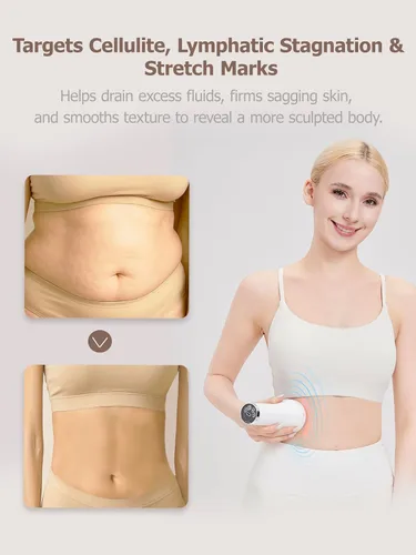 Miniatura 2 de DiDEER Masajeador de Drenaje Linfático y Herramienta de Masaje Anticelulítico, para Piernas, Brazos y Abdomen, Cuerpo, Ayuda a Reducir Estrías