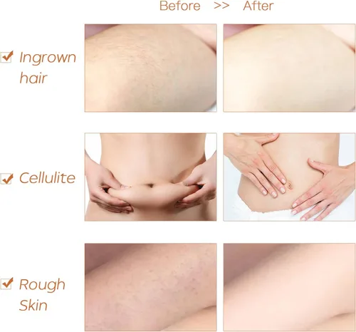 Miniatura 7 de ICANdOIT Cepillo corporal muy rígido para hombres y mujeres, cepillo de piel seca de mango largo para celulitis y drenaje linfático con cerdas