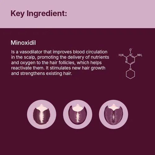 Miniatura 6 de Santo Remedio Tratamiento de crecimiento del cabello para mujeres, ayuda a estimular el crecimiento del cabello y reducir la pérdida de cabello