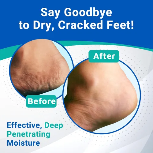 Miniatura 5 de Crema para talones Dermal Therapy, 3 onzas
