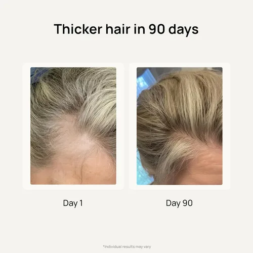 Miniatura 3 de Lunos Grow Hair Growth Supplements - Vitaminas para el cabello de 17 ingredientes para mujeres y hombres con biotina, palma enana americana