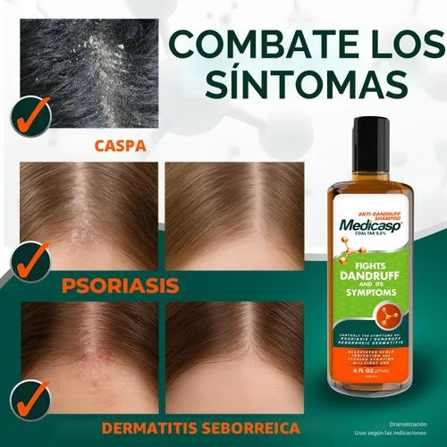 Miniatura 4 de MEDICASP Shampoo anticaspa con alquitrán de hulla, Trata la caspa, dermatitis seborreica y psoriasis, 6 onzas líquidas