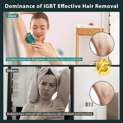 Miniatura 5 de Depilación láser IPL para mujeres y hombres, resultados de larga duración, 999,999 flashes, depilación sin dolor, dispositivo de depilación